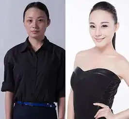  整容后她们变的不一样了,回国都成问题