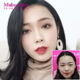  切开双眼皮切开双眼皮耀眼术仿生态斩男桃花眼萌系少女元气眼芭比电眼max闭眼隐痕悦美整形