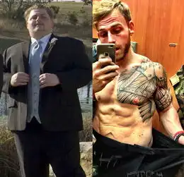  男子疯狂减肥腹部一半肌肉一半是松皮